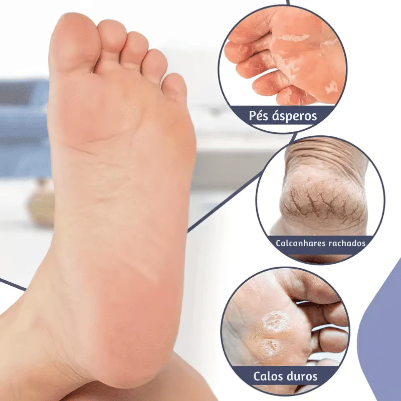 BelleCare – Meias Hidratantes Anti-Rachaduras para os Pés - Image 3