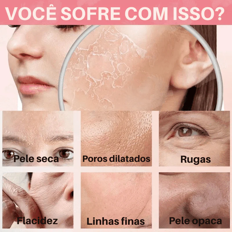 CollageSkin – Máscara Anti-idade com Efeito Lifting - Image 3