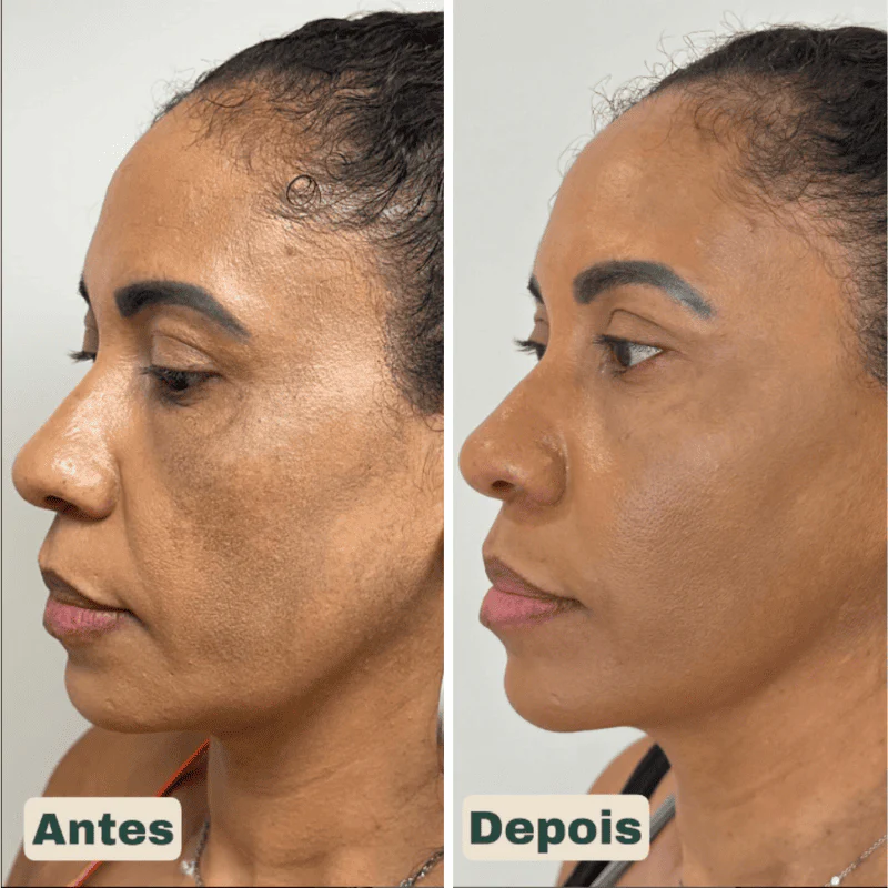CollageSkin – Máscara Anti-idade com Efeito Lifting - Image 5