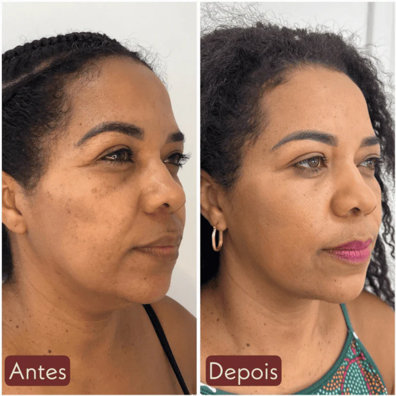CollageSkin – Máscara Anti-idade com Efeito Lifting - Image 8