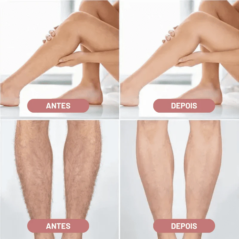 Depilador Elétrico 4 em 1 - DermaBelle® + Brindes - Image 3