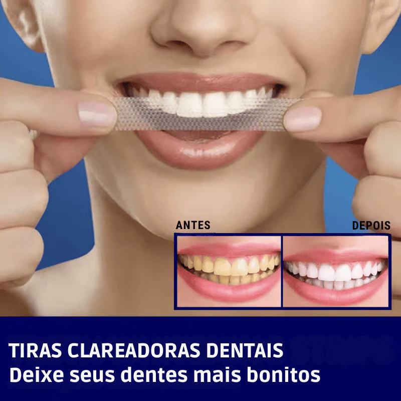 SmileKit – Clareamento total em 30 minutos - Image 2