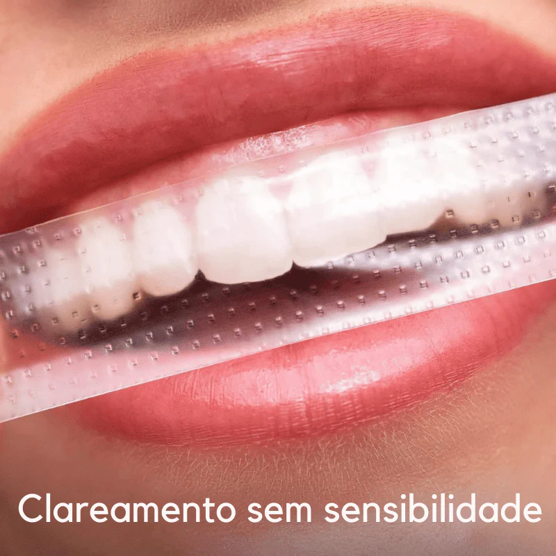 SmileKit – Clareamento total em 30 minutos - Image 3