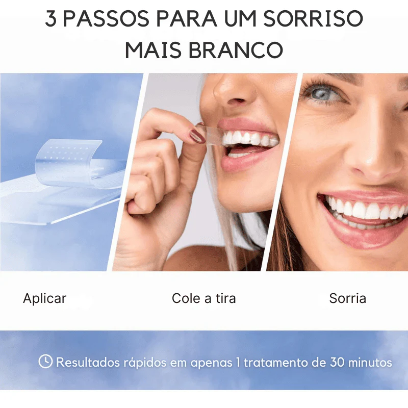 SmileKit – Clareamento total em 30 minutos - Image 4